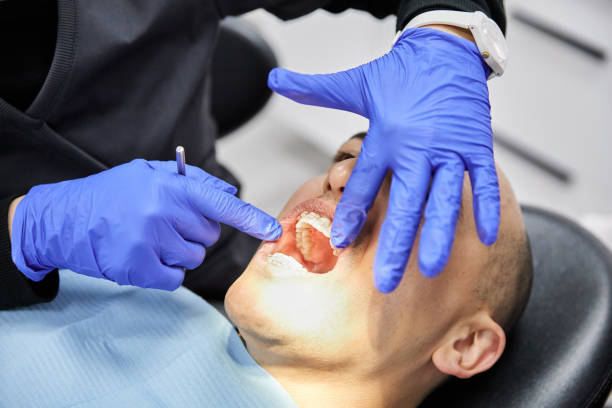 Best Emergency Root Canal Therapy in Caldwell, TX